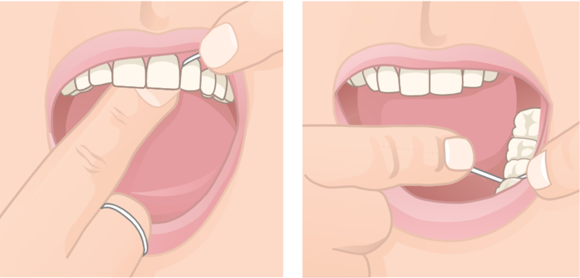 come si usa il filo interdentale