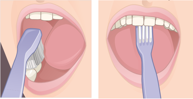 Lo spazzolamento orizzontale deve essere limitato alla superfici masticanti. Con la punta dello spazzolino pulire la parte interna dei denti anteriori, superiori ed inferiori