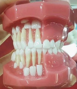 corretta posizione dei denti da latte rispetto ai definitivi