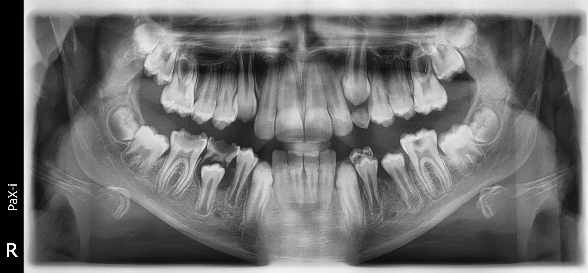 Ortopanoramica dentale